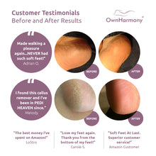 Load image into Gallery viewer, Electric Callus Remover CR1700 Series by Own Harmony - Professional Pedicure Tools (2020 Design) with 3 Rollers