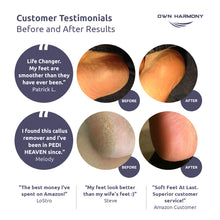 Load image into Gallery viewer, Electric Callus Remover CR1700 Series by Own Harmony - Professional Pedicure Tools (2020 Design) with 3 Rollers