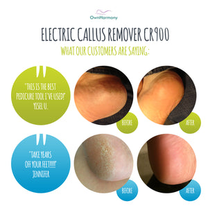 Electric Callus Remover CR900 Series by Own Harmony with 3 Rollers